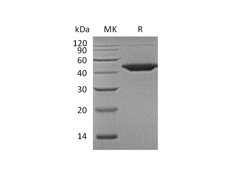 Recombinant Human WIF-1 (C-6His)