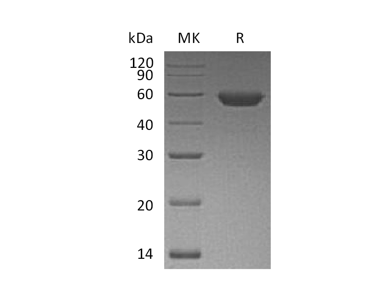 Recombinant Human ROR2 (C-6His)