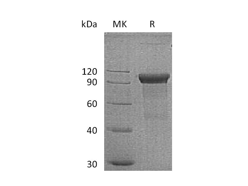 Recombinant Human ROR1 (C-Fc)