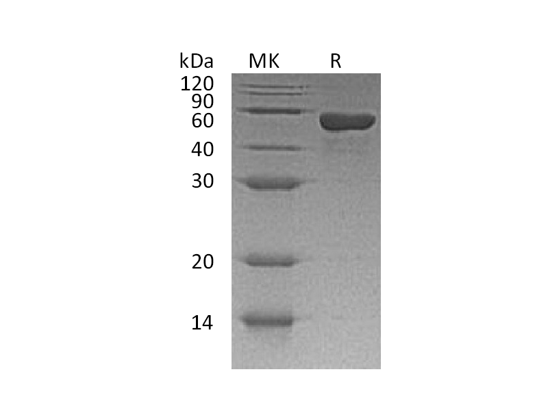 Recombinant Human sCD4 (C-6His)