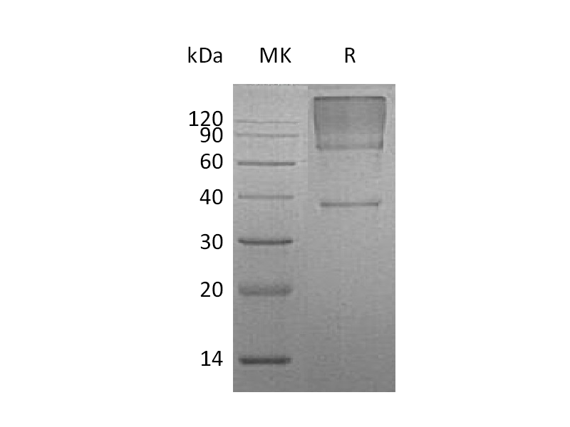 Recombinant Human GPC3 (C-6His)