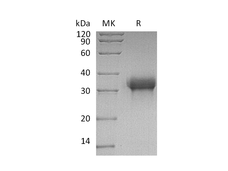 Recombinant Human Siglec-15 (C-6His)