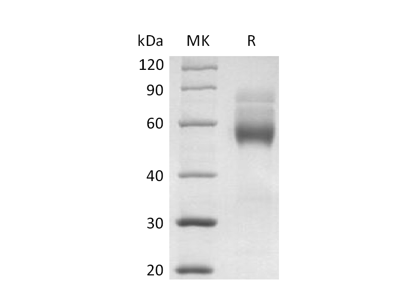 Recombinant Human HVEM (C-mFc)