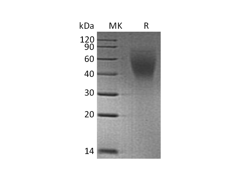 Recombinant Human CA125 (C-6His)