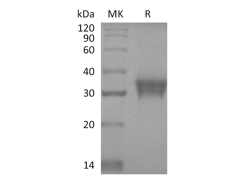 Recombinant Human STC-1 (C-6His)