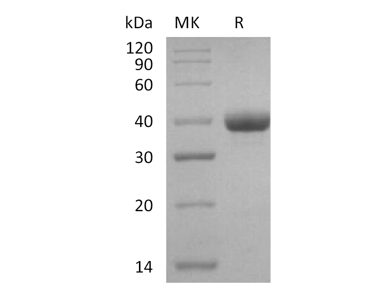 Recombinant Human IgG3 Fc