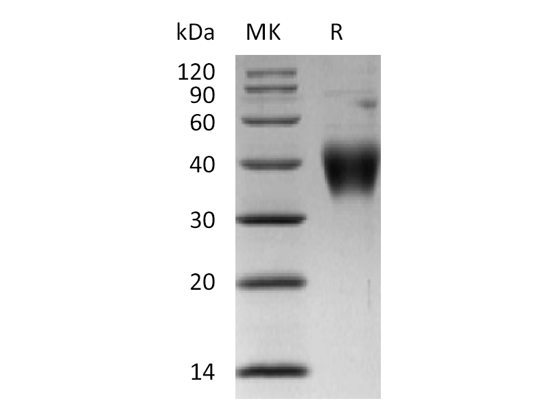 Recombinant Human TSLP R(C-6His)