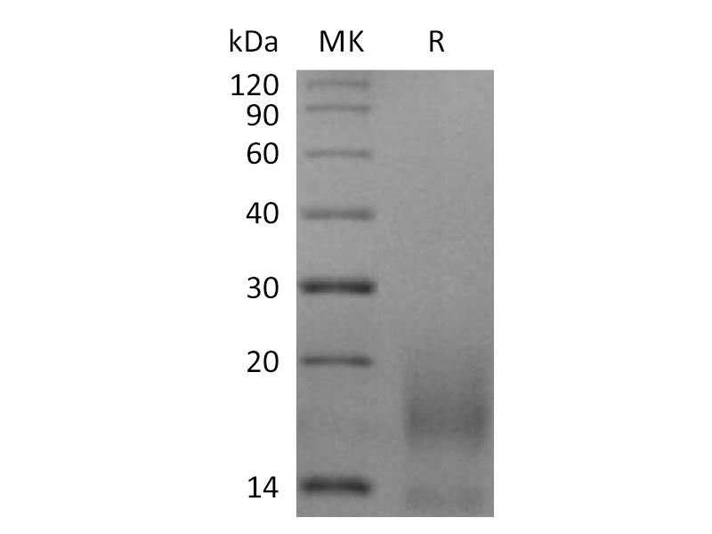 Recombinant Human BCMA (N-6His-Flag)