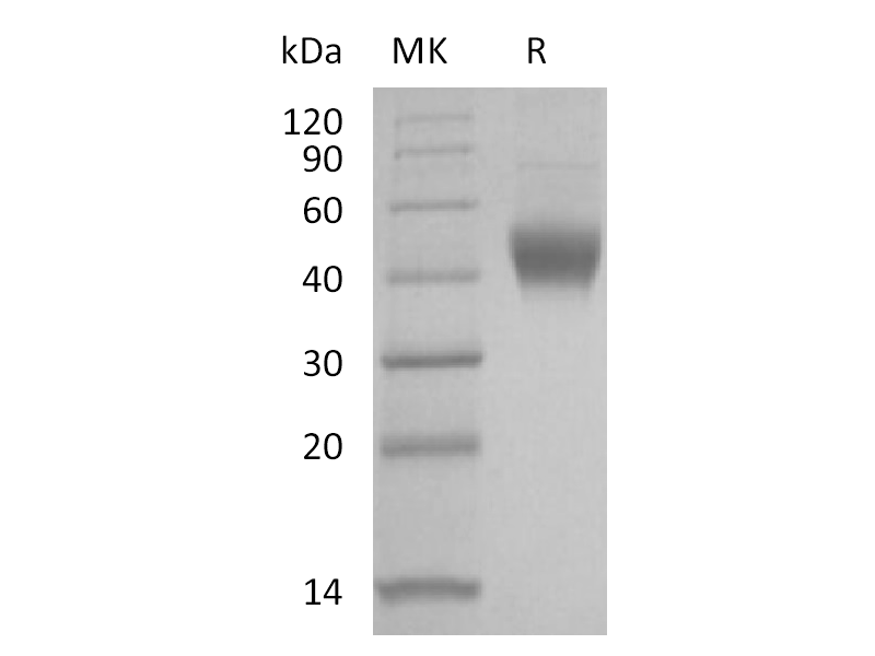 Recombinant Human IL-7RA (C-6His)