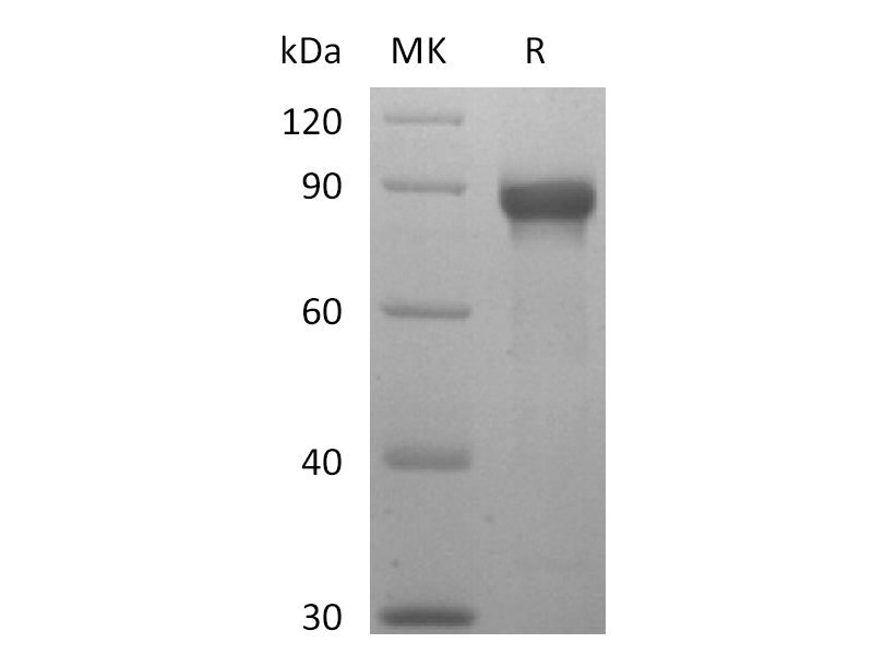 Recombinant Human Siglec-8 (C-mFc)