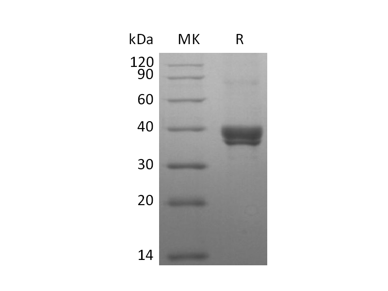 Recombinant Human CD299 (N-8His-Flag)