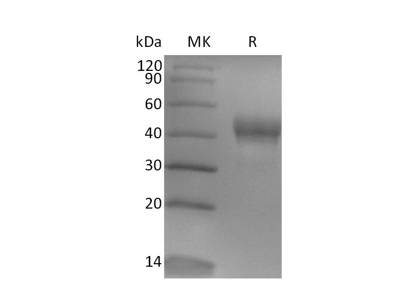 Recombinant Human TROP-2 (248AA, C-6His)