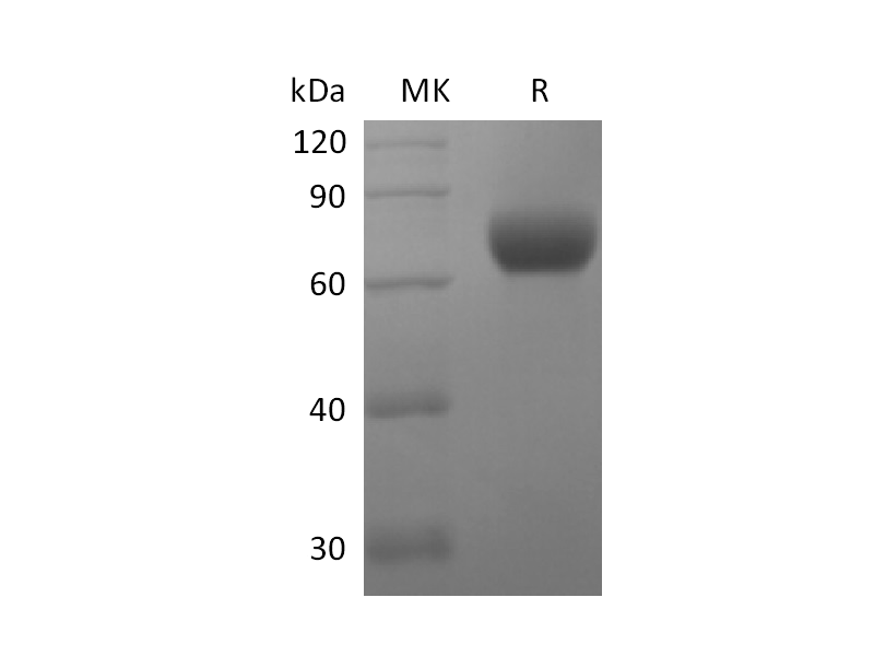 Recombinant Human CD244 (C-Fc)