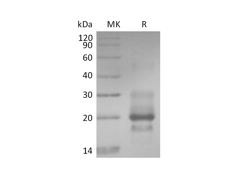 Recombinant Human TRAIL R1 (C-6His)