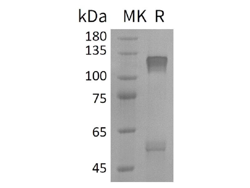 Recombinant Human IGF-I R (C-6His)