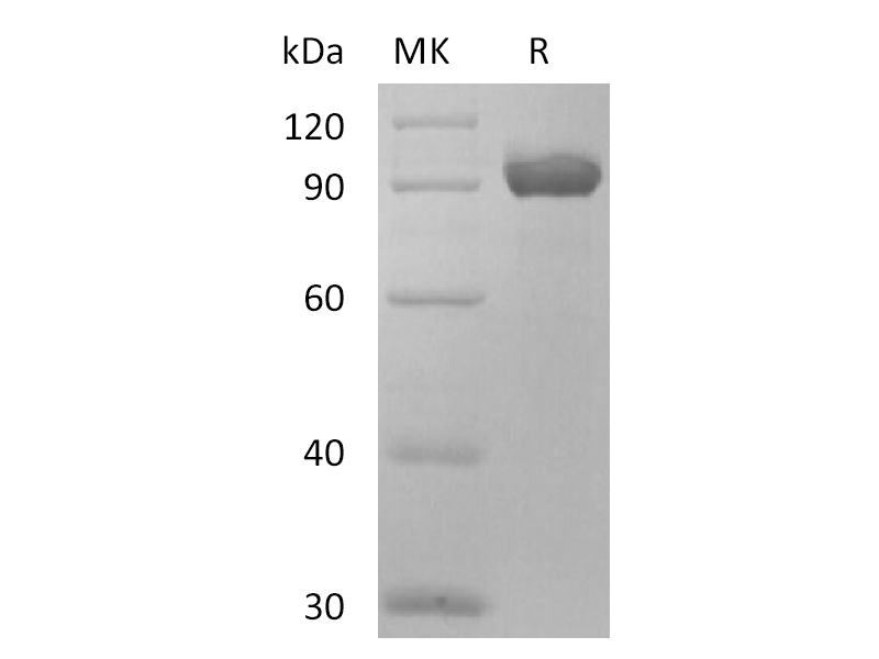 Recombinant Human NPR3 (C-Fc)