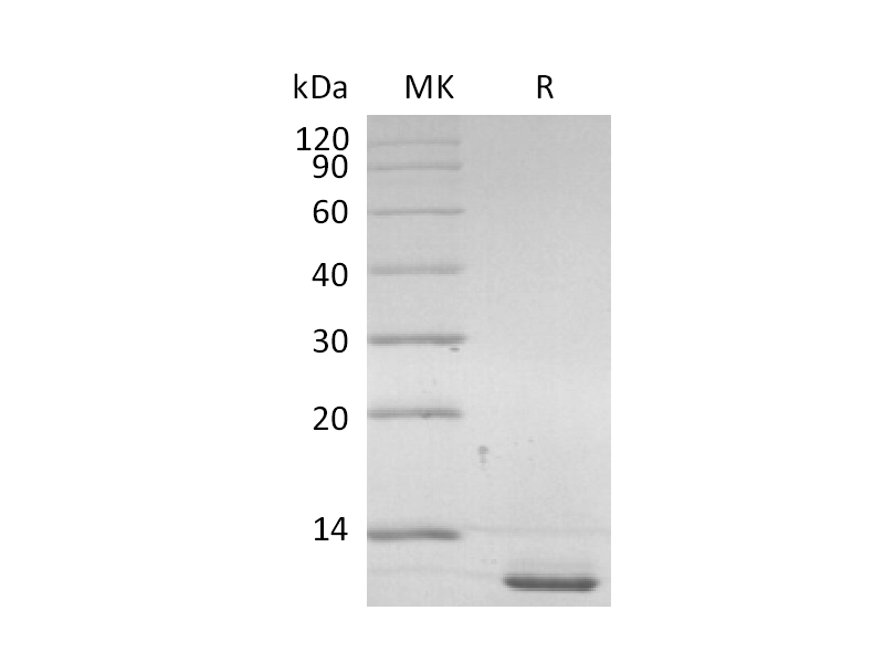 Recombinant Human CD9 (C-6His)