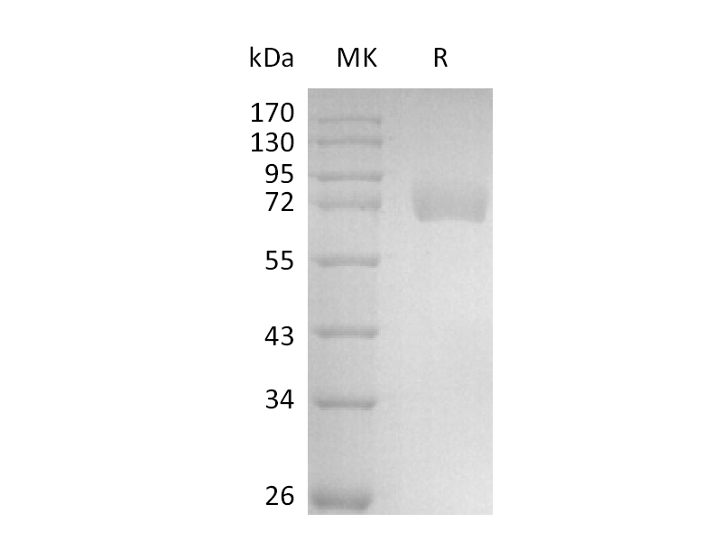 Recombinant Human Siglec-6 (C-Fc)