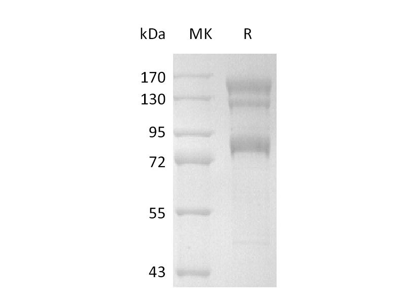 Recombinant Human Integrin alpha V beta 8 Heterodimer (C-6His)