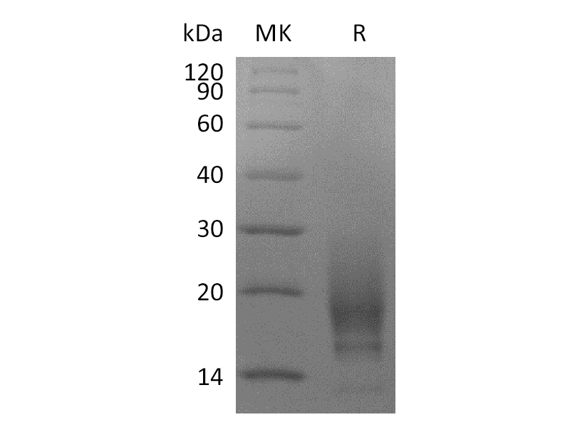Recombinant Human CD63 (N-6His)
