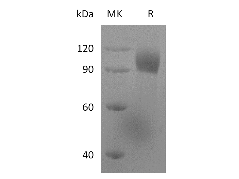 Recombinant Human LILRB1 (C-mFc)