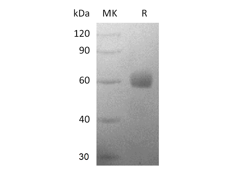 Recombinant Human TREM-2 (C-Fc)