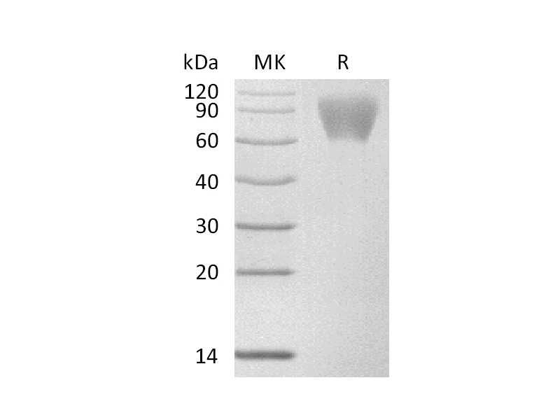 Recombinant Human GUCY2C (C-6His)