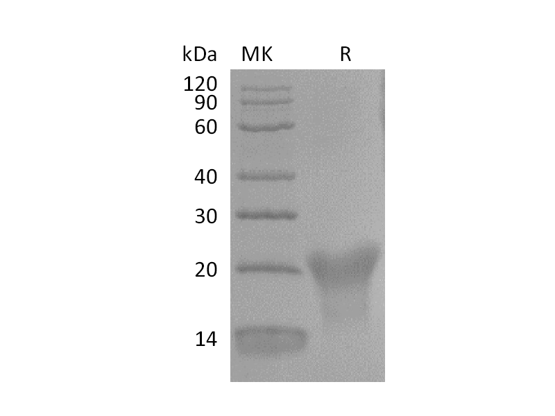 Recombinant Human BAFFR (C-6His)