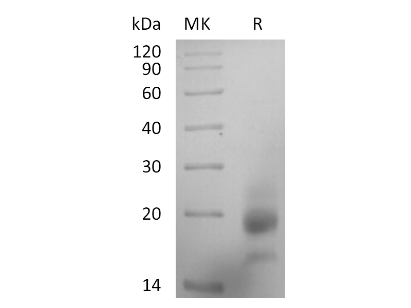 Recombinant Human RSPO3 (C-6His)