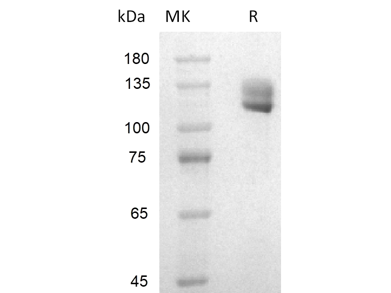 Recombinant Human VCAM-1 (C-Fc)