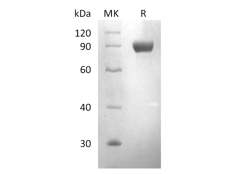 Recombinant Human DDR1 (C-Fc)