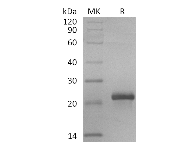 Recombinant Human RSPO2 (C-Flag)