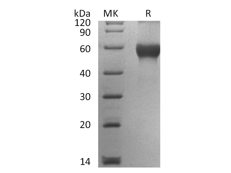 Recombinant Human TL1A (N-mFc)