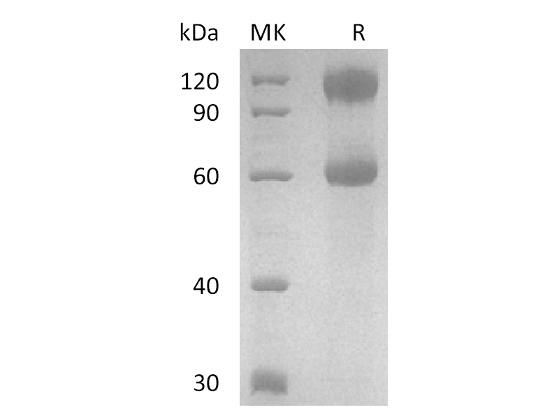 Recombinant Human IL-2 R beta&IL-2 R alpha&IL-2 R gamma Heterotrimer Protein (C-Fc)