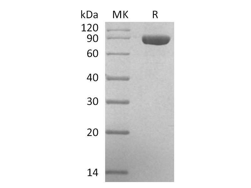 Recombinant Human GUSB (C-6His)