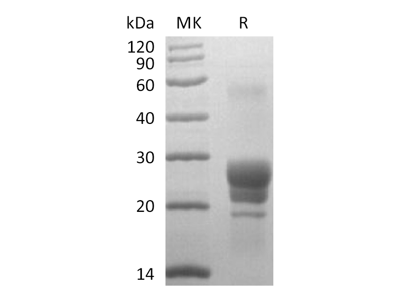 Recombinant Human TL1A (N-6His)