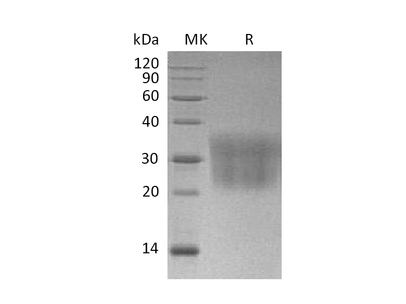 Recombinant Mouse CCL2 (C-6His)