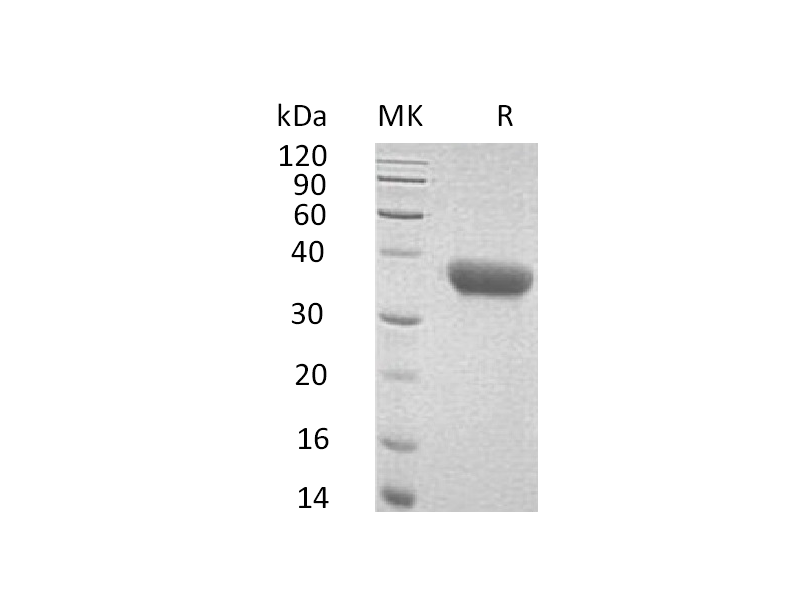 Recombinant Mouse CXCL16 (C-6His)