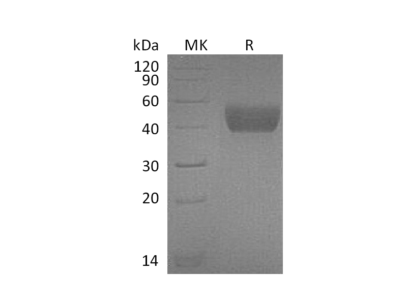 Recombinant Mouse FSTL1 (C-6His)