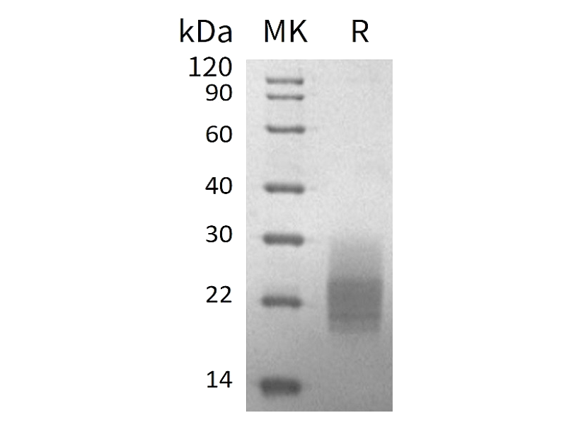 Recombinant Mouse GM-CSF (C-6His)