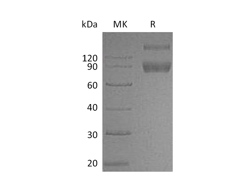 Recombinant Mouse IL-1R2 (C-Fc)