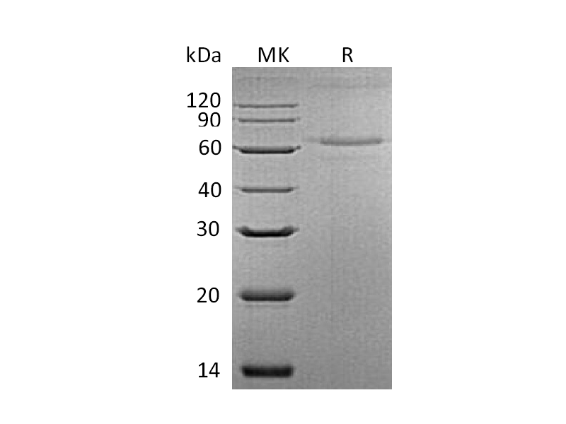 Recombinant Mouse IL-27 (C-6His)