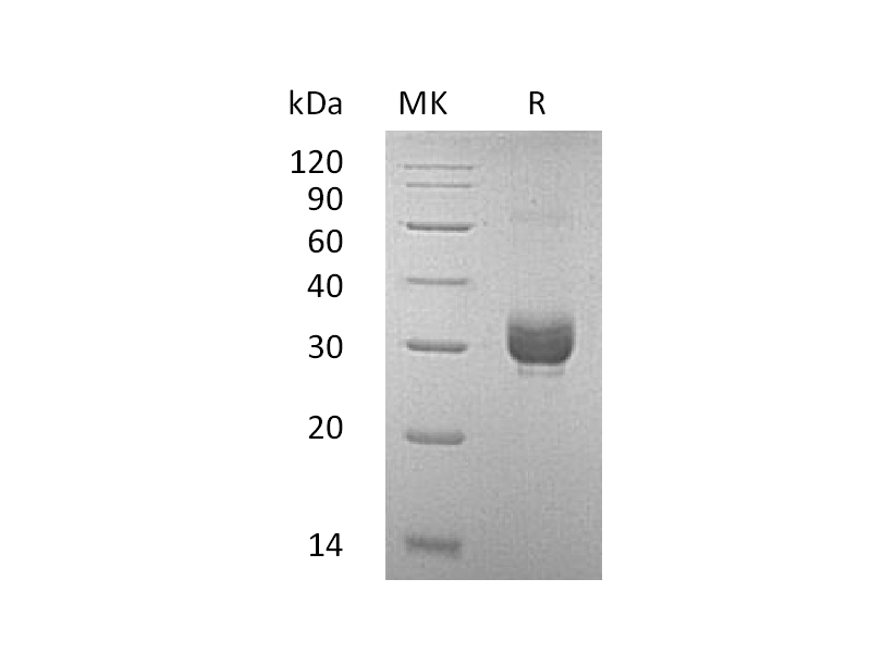 Recombinant Mouse Noggin (C-6His)