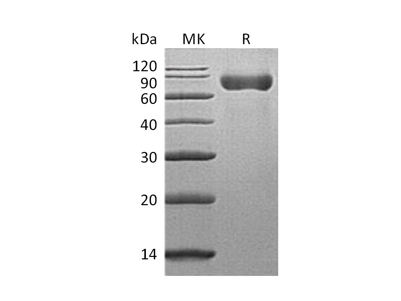 Recombinant Mouse SLAMF3 (C-6His)