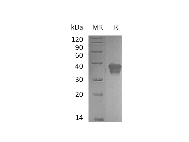 Recombinant Mouse TSLP R (C-6His)