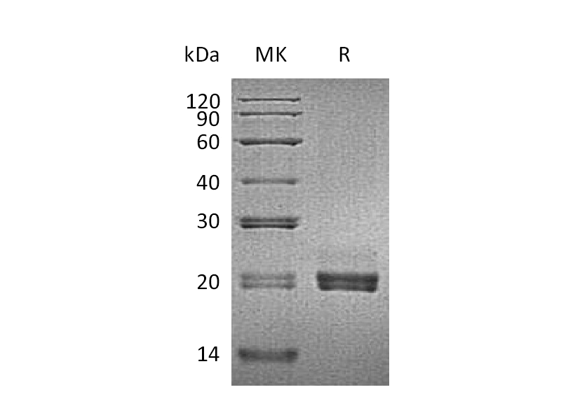 Recombinant Mouse CD40L (N-6His)