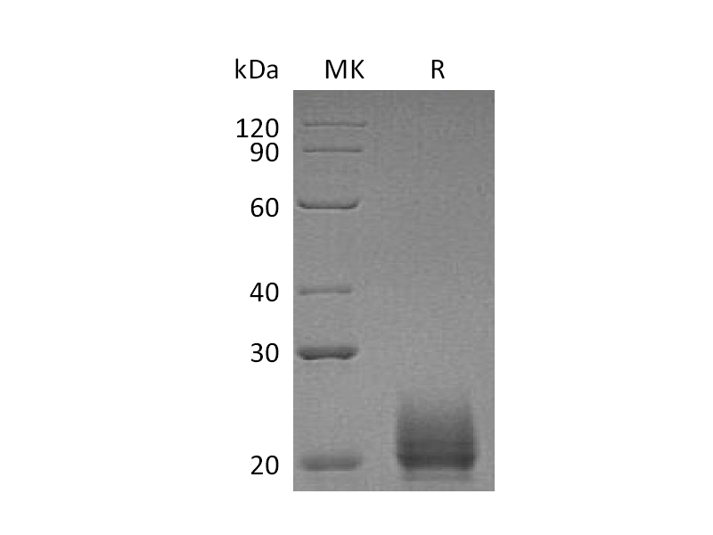 Recombinant Mouse CXCL9 (C-6His)