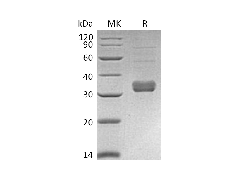 Recombinant Mouse Collectin-11 (C-6His)