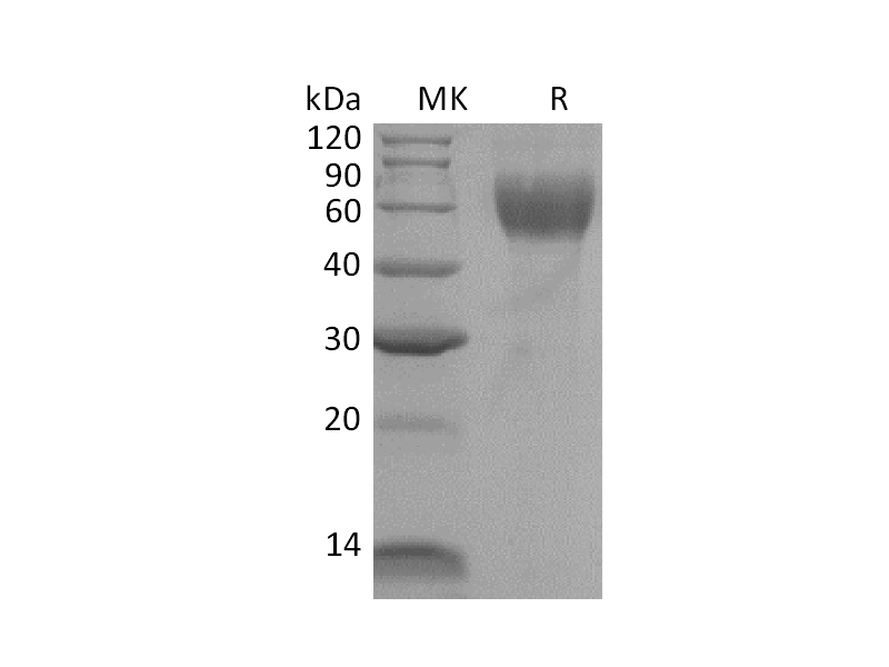 Recombinant Mouse IL-1R1 (C-6His)