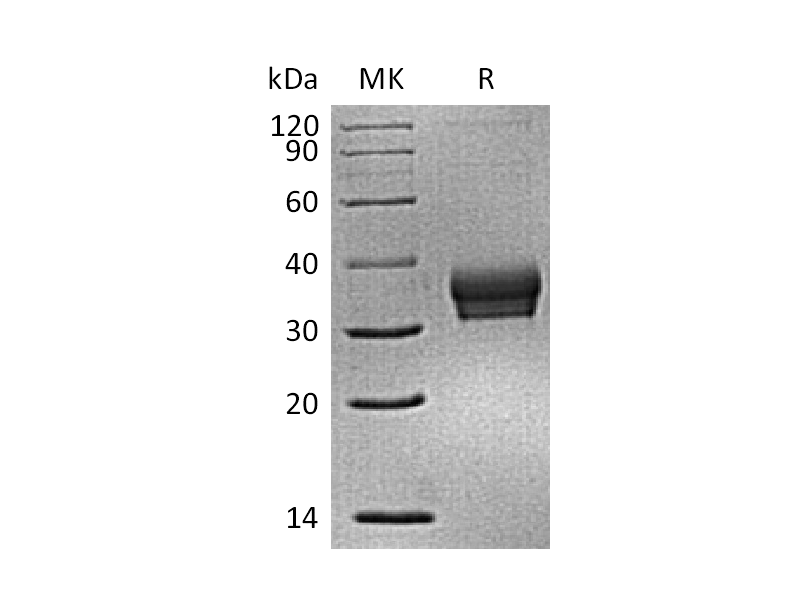 Recombinant Mouse Siglec-15 (C-6His)